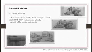 Broussard Bracket
• Garford Broussard
• A conventional bracket with a closed, rectangular, vertical
slot 0.018” X 0.046” which is formed when the
bracket is welded onto the band material
Clinical applications of the Broussard auxiliary edgewise bracket. Am J Orthod.1964.
 