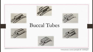 Buccal Tubes
Orthodontics current principles & techniques
 