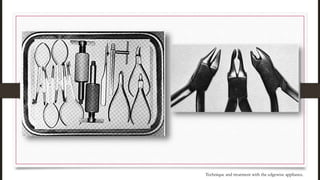 Technique and treatment with the edgewise appliance.
 