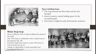 Space-holding loops.
• The loop between the first molar and the first
bicuspid
• shown is passive, merely holding space for the
second bicuspid.
• level where it might be easily deformed by occlusion.
Molar Stop loop
shows a different form of space-holding loop ahead of
the molar
tube. This loop, in combination with a similar loop on
the opposite side, will
hold arch length from molar to molar. This form of
stop loop also has the ad-
vantage of adjustability, in both mesiodistal and
buccolingual directions
 