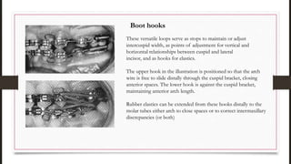 These versatile loops serve as stops to maintain or adjust
intercuspid width, as points of adjustment for vertical and
horizontal relationships between cuspid and lateral
incisor, and as hooks for elastics.
The upper hook in the illustration is positioned so that the arch
wire is free to slide distally through the cuspid bracket, closing
anterior spaces. The lower hook is against the cuspid bracket,
maintaining anterior arch length.
Rubber elastics can be extended from these hooks distally to the
molar tubes either arch to close spaces or to correct intermaxillary
discrepancies (or both)
Boot hooks
 