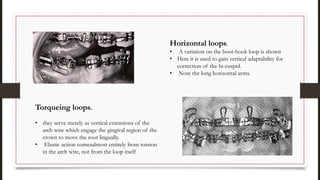 Horizontal loops.
• A variation on the boot-hook loop is shown
• Here it is used to gain vertical adaptability for
correction of the bi-cuspid.
• Note the long horizontal arms.
Torqueing loops.
• they serve merely as vertical extensions of the
arch wire which engage the gingival region of the
crown to move the root lingually.
• Elastic action comesalmost entirely from torsion
in the arch wire, not from the loop itself
 