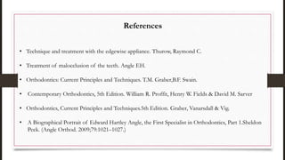 References
• Technique and treatment with the edgewise appliance. Thurow, Raymond C.
• Treatment of malocclusion of the teeth. Angle EH.
• Orthodontics: Current Principles and Techniques. T.M. Graber,B.F. Swain.
• Contemporary Orthodontics, 5th Edition. William R. Proffit, Henry W. Fields & David M. Sarver
• Orthodontics, Current Principles and Techniques.5th Edition. Graber, Vanarsdall & Vig.
• A Biographical Portrait of Edward Hartley Angle, the First Specialist in Orthodontics, Part 1.Sheldon
Peck. (Angle Orthod. 2009;79:1021–1027.)
 