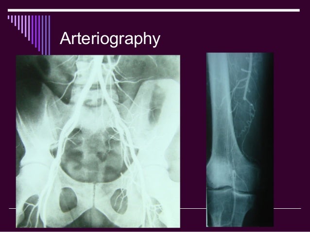 Special Contract X Ray Methods Of Examination