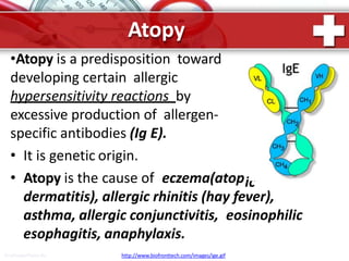 Atopy
ic
•Atopy is a predisposition toward
developing certain allergic
hypersensitivity reactions by
excessive production of allergen-
specific antibodies (Ig E).
• It is genetic origin.
• Atopy is the cause of eczema(atop
dermatitis), allergic rhinitis (hay fever),
asthma, allergic conjunctivitis, eosinophilic
esophagitis, anaphylaxis.
ProPowerPoint.Ru http://www.biofronttech.com/images/ige.gif
 