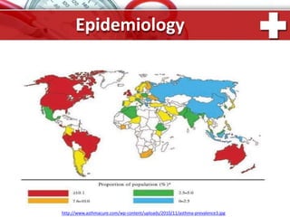 Epidemiology
http://www.asthmacure.com/wp-content/uploads/2010/11/asthma-prevalence3.jpg
 