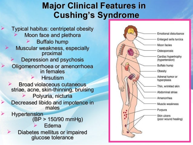 Adrenal Disorders Addison S Crisis