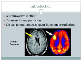 Introduction
 A noninvasive method
 To assess tissue perfusion
 No exogenous contrast agent injection or radiation
Venous
Angioma
 