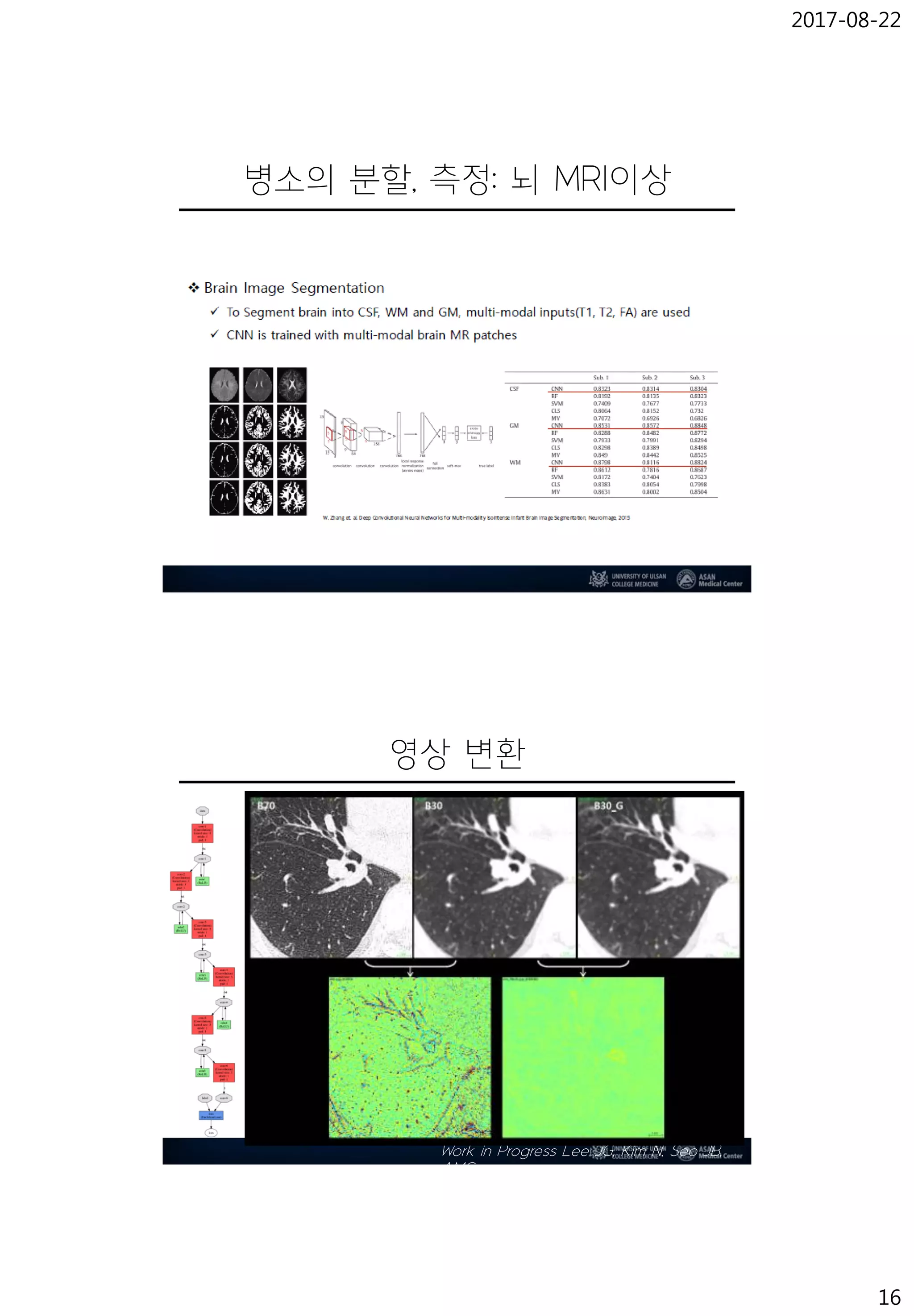 2017-08-22
16
병소의 분할, 측정: 뇌 MRI이상
영상 변환
Work in Progress Lee JG, Kim N, Seo JB,
AMC
 