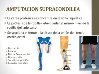 AMPUTACION SUPRACONDILEA
 La carga protésica se concentra en la zona isquiática.
 La prótesis de la rodilla debe quedar al mismo nivel de la
rodilla del lado sano.
 Se secciona el femur a la altura de la unión del tercio
medio distal
1.Tipo de pie
2. Rotador
3.Tipo de Componentes
4.Tipo de rodilla
5. Socket y suspensión
6. Cobertor cosmético
 