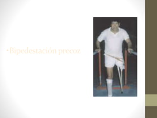 •Bipedestación precoz
 