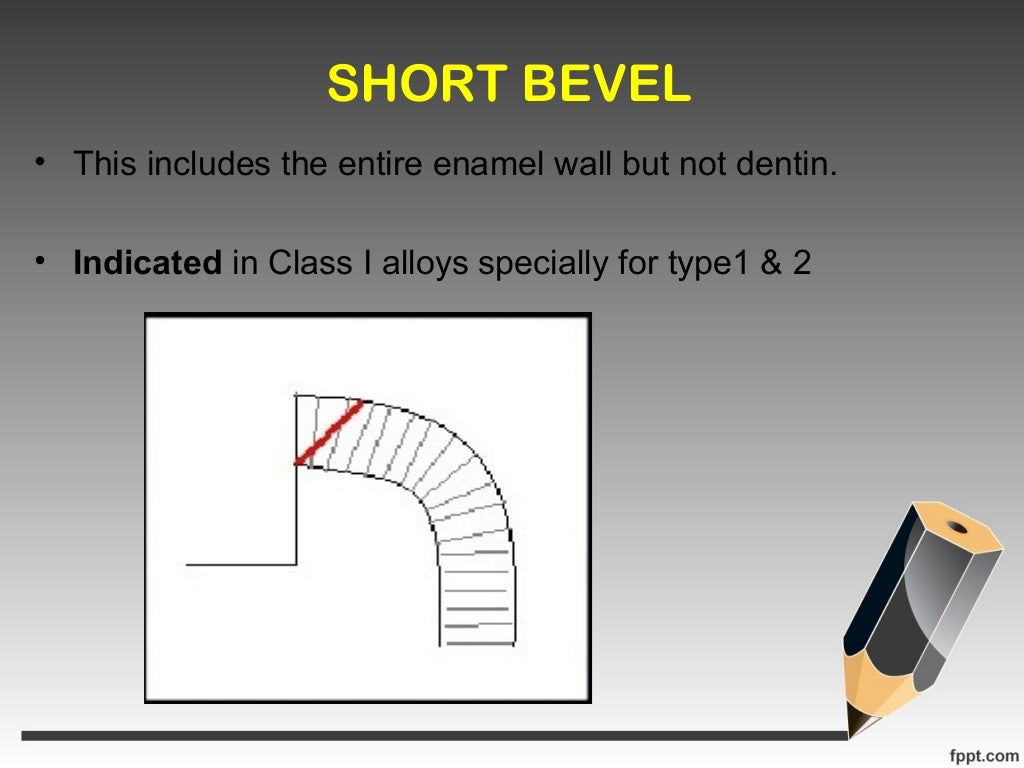 Bevels and flares in dental restoration