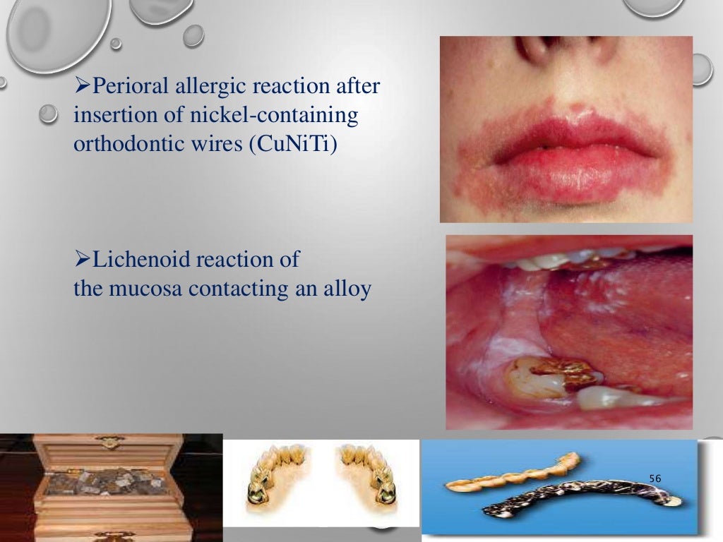 of dental materials kelly