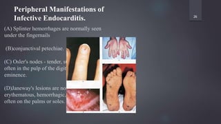 (A) Splinter hemorrhages are normally seen
under the fingernails
(B)conjunctival petechiae.
(C) Osler's nodes - tender, subcutaneous nodules,
often in the pulp of the digits or the thenar
eminence.
(D)Janeway's lesions are nontender,
erythematous, hemorrhagic, or pustular lesions,
often on the palms or soles.
26
Peripheral Manifestations of
Infective Endocarditis.
 