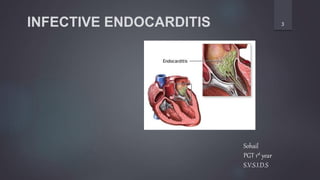 INFECTIVE ENDOCARDITIS 3
Sohail
PGT 1st year
S.V.S.I.D.S
 