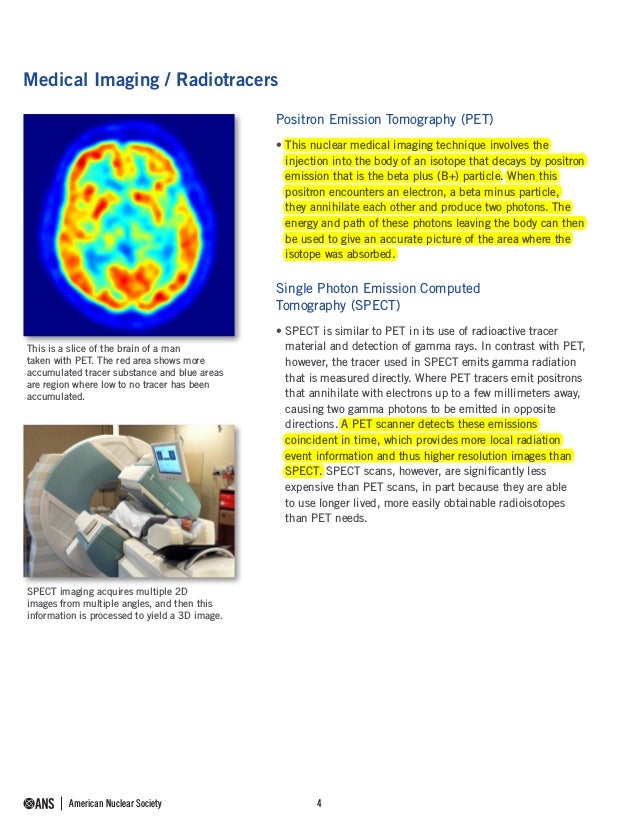 Medical Use of Radioisotopes