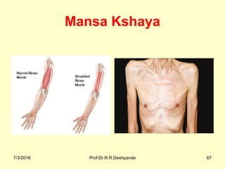 Mansa Kshaya
7/3/2018 Prof.Dr.R.R.Deshpande 67
 