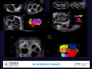 Dr.Bharati Dhorepatil 16
 