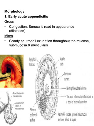 4.intestine3 | PPT