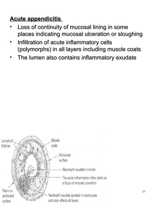 4.intestine3 | PPT