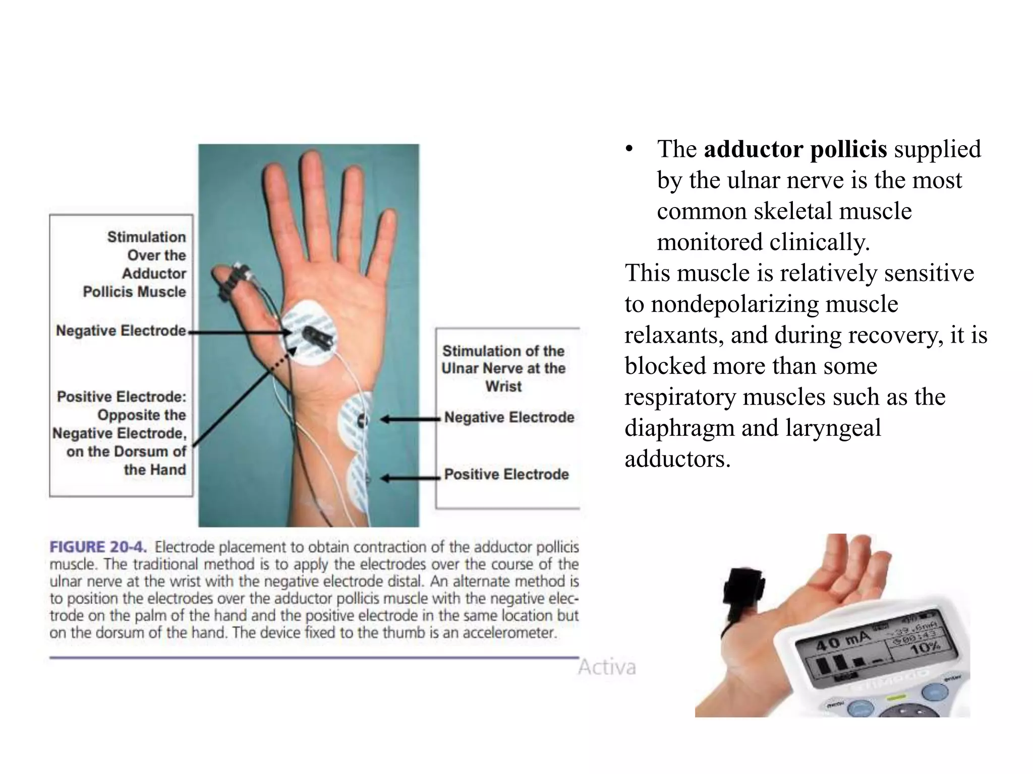 • The adductor pollicis supplied
by the ulnar nerve is the most
common skeletal muscle
monitored clinically.
This muscle is relatively sensitive
to nondepolarizing muscle
relaxants, and during recovery, it is
blocked more than some
respiratory muscles such as the
diaphragm and laryngeal
adductors.
 