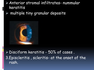 4 fungal And Viral Keratitis PPTX