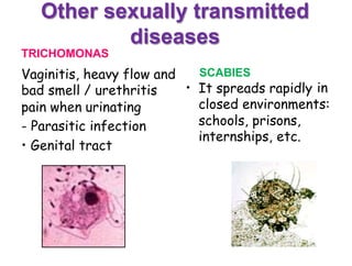Other sexually transmitted
diseases
TRICHOMONAS
SCABIES
It spreads rapidly
Vaginitis, heavy flow and
bad smell / urethritis
pain when urinating
• in
closed environments:
schools, prisons,-
•
Parasitic infection
internships, etc.
Genital tract
 