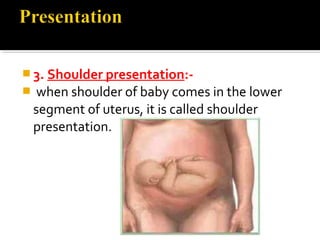  3. Shoulder presentation:-
 when shoulder of baby comes in the lower
segment of uterus, it is called shoulder
presentation.
 