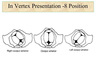 In Vertex Presentation -8 Position
 