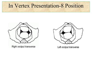 In Vertex Presentation-8 Position
 