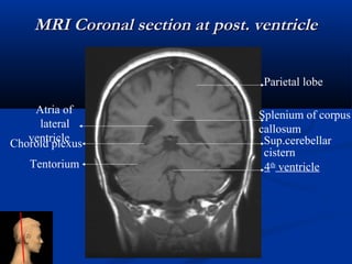 Splenium Mri Con Ronal Radiological Techniques of brain Space occupying lesion | PPT