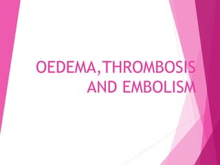 OEDEMA,THROMBOSIS
AND EMBOLISM
 