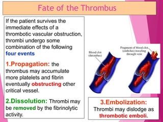 Fate of the Thrombus
If the patient survives the
immediate effects of a
thrombotic vascular obstruction,
thrombi undergo some
combination of the following
four events
1.Propagation: the
thrombus may accumulate
more platelets and fibrin
eventually obstructing other
critical vessel.
2.Dissolution: Thrombi may
be removed by the fibrinolytic
activity.
3.Embolization:
Thrombi may dislodge as
thrombotic emboli.
 