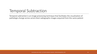 Temporal subtraction is an image processing technique that facilitates the visualization of
pathologic change across serial chest radiographic images acquired from the same patient
Temporal Subtraction
16MUHAMMAD ARIF AFRIDI | LECTURER IN MEDICAL IMAGING | DRARIFAFRIDI@GMAIL.COM
 