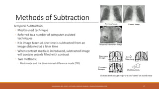 Methods of Subtraction
Temporal Subtraction
◦ Mostly used technique
◦ Referred to a number of computer assisted
techniques
◦ It is image taken at one time is subtracted from an
image obtained at a later time
◦ When contrast media is introduced, subtracted image
will contain vessels filled with contrast
◦ Two methods;
◦ Mask mode and the time-interval difference mode (TID)
17MUHAMMAD ARIF AFRIDI | LECTURER IN MEDICAL IMAGING | DRARIFAFRIDI@GMAIL.COM
 