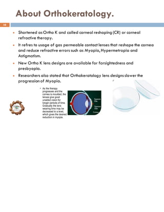 About Orthokeratology.
l Shortened asOrtho K and called corneal reshaping (CR) or corneal
refractive therapy.
l It refres to usage of gas permeable contact lenses that reshape the cornea
and reduce refractive errors such as Myopia, Hypermetropia and
Astigmatism.
l New Ortho K lens designs are available for farsightedness and
presbyopia.
l Researchers also stated that Orthokeratology lens designsslower the
progression of Myopia.
38
 