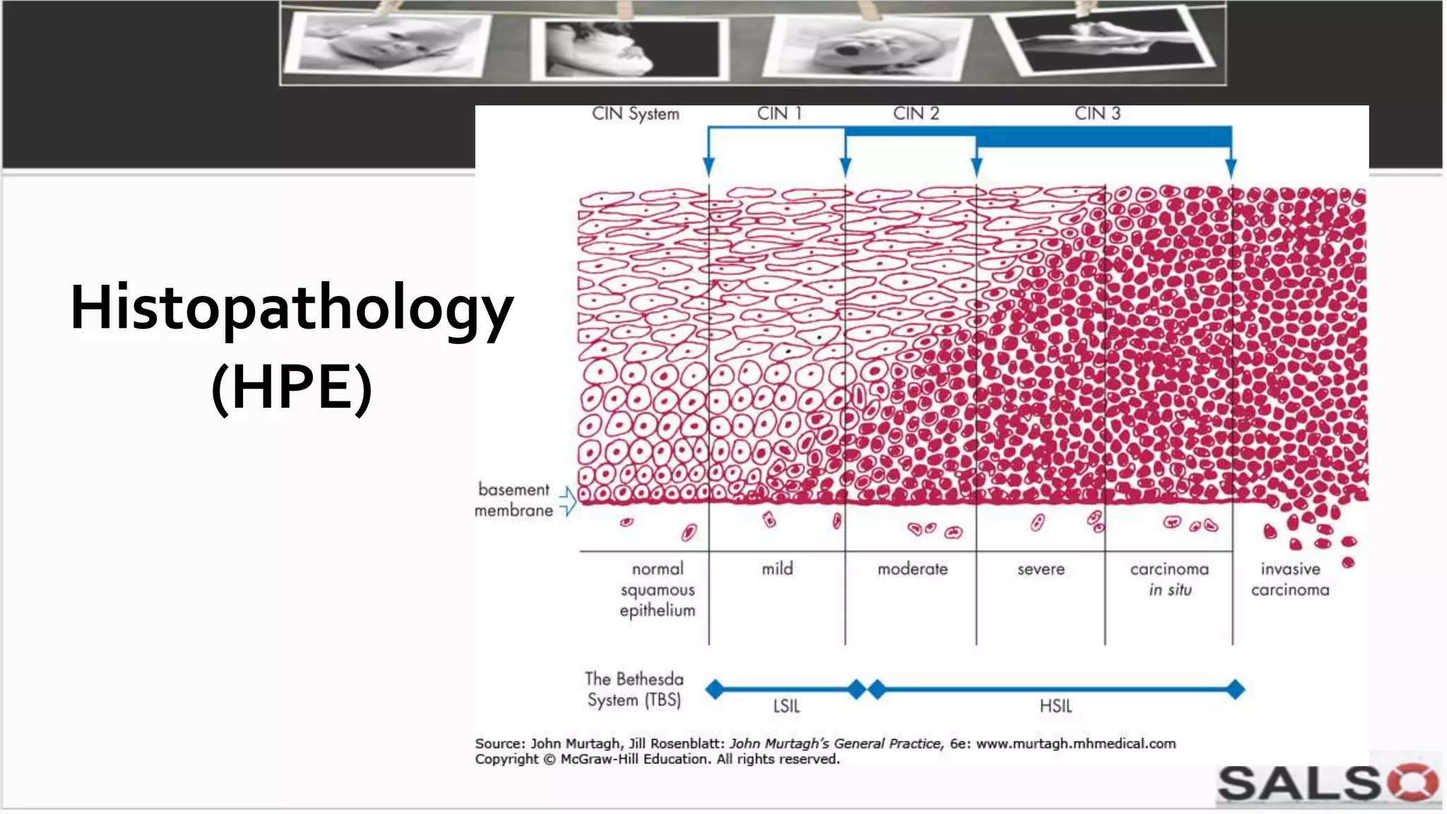 Histopathology
(HPE)
 