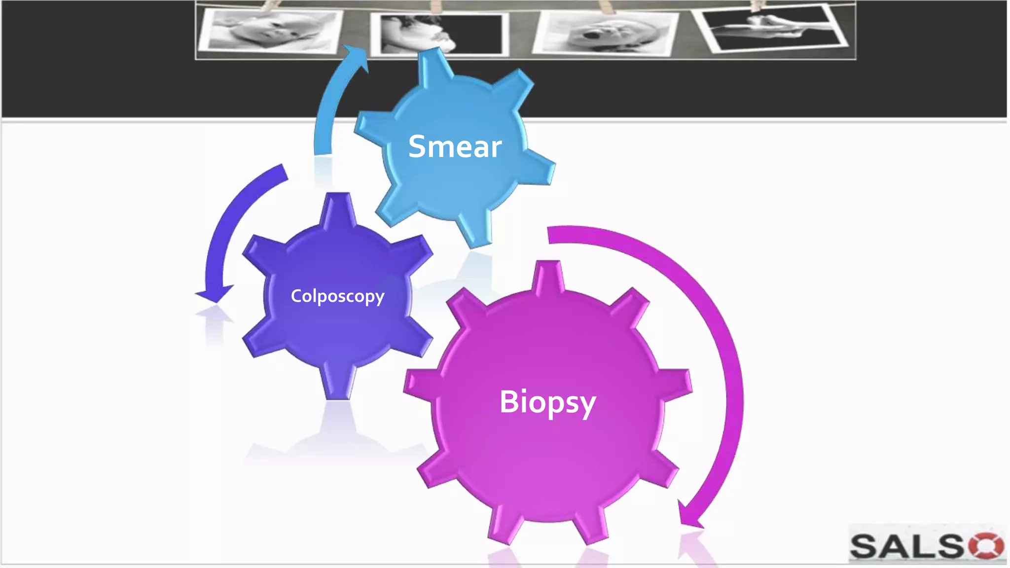 Biopsy
Colposcopy
Smear
 