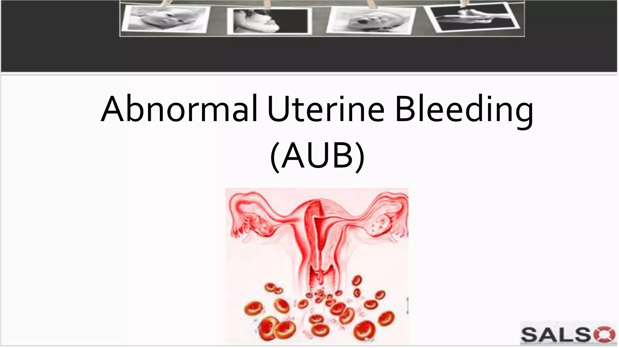 Abnormal Uterine Bleeding
(AUB)
 