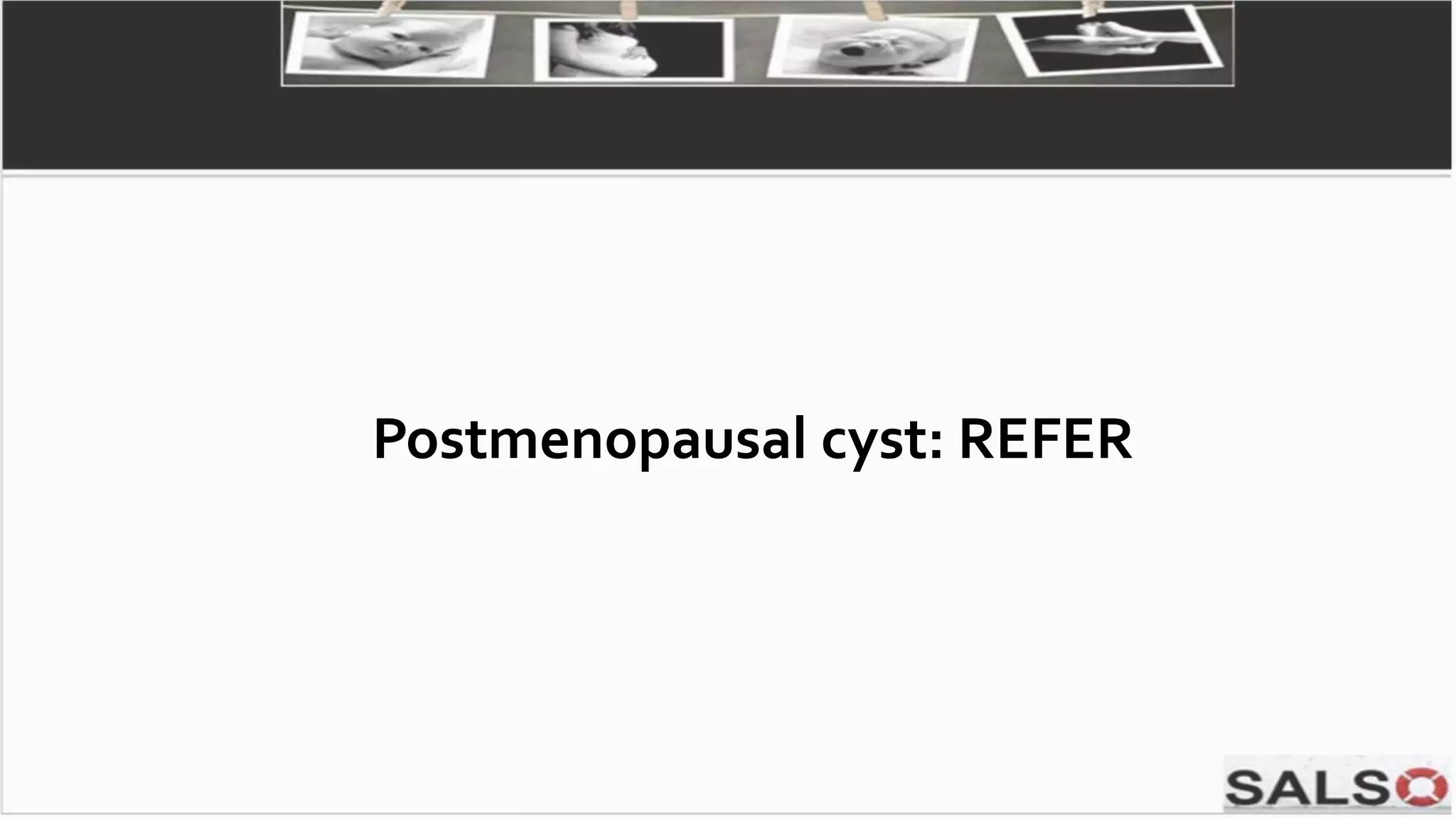 Postmenopausal cyst: REFER
 