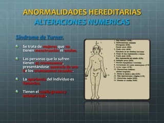 ANORMALIDADES HEREDITARIAS
ALTERACIONES NUMERICAS
Síndrome de Turner.
Se trata de mujeres que no
tienen menstruación ni ovulan.
Las personas que lo sufren
tienen 45 cromosomas,
presentándose ausencia de uno
de los cromosomas sexuales.
La apariencia del individuo es
femenina.
Tienen el cuello grueso y
estatura baja.
 