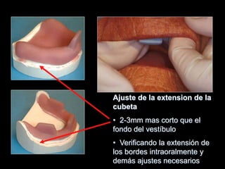 Ajuste de la extension de la
cubeta
• 2-3mm mas corto que el
fondo del vestíbulo
• Verificando la extensión de
los bordes intraoralmente y
demás ajustes necesarios
 