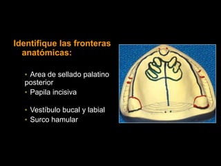 Identifique las fronteras
anatómicas:
• Area de sellado palatino
posterior
• Papila incisiva
• Vestíbulo bucal y labial
• Surco hamular
 