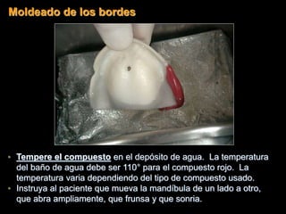 • Tempere el compuesto en el depósito de agua. La temperatura
del baño de agua debe ser 110° para el compuesto rojo. La
temperatura varia dependiendo del tipo de compuesto usado.
• Instruya al paciente que mueva la mandíbula de un lado a otro,
que abra ampliamente, que frunsa y que sonria.
Moldeado de los bordes
 