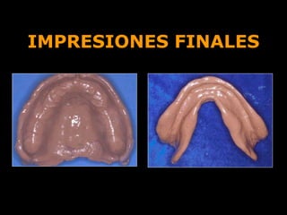 IMPRESIONES FINALES
 