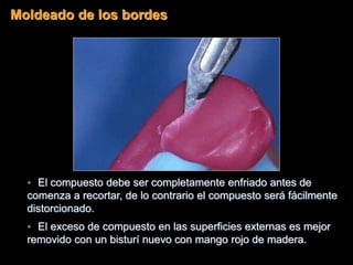• El compuesto debe ser completamente enfriado antes de
comenza a recortar, de lo contrario el compuesto será fácilmente
distorcionado.
• El exceso de compuesto en las superficies externas es mejor
removido con un bisturí nuevo con mango rojo de madera.
Moldeado de los bordes
 