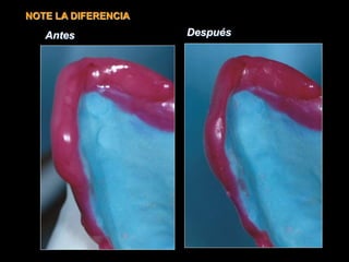 NOTE LA DIFERENCIA
Antes Después
 