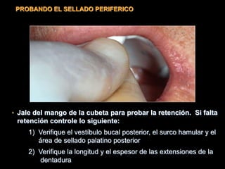 • Jale del mango de la cubeta para probar la retención. Si falta
retención controle lo siguiente:
1) Verifique el vestíbulo bucal posterior, el surco hamular y el
área de sellado palatino posterior
2) Verifique la longitud y el espesor de las extensiones de la
dentadura
PROBANDO EL SELLADO PERIFERICO
 