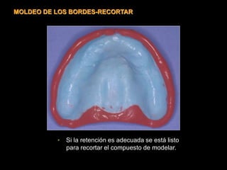 • Si la retención es adecuada se está listo
para recortar el compuesto de modelar.
MOLDEO DE LOS BORDES-RECORTAR
 