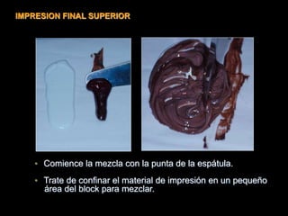 • Comience la mezcla con la punta de la espátula.
• Trate de confinar el material de impresión en un pequeño
área del block para mezclar.
IMPRESION FINAL SUPERIOR
 